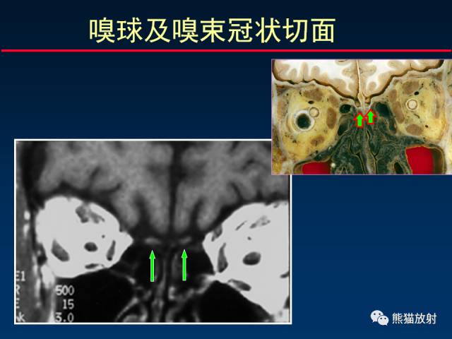【柳澄讲坛】MR新技术在颅神经研究中的应用