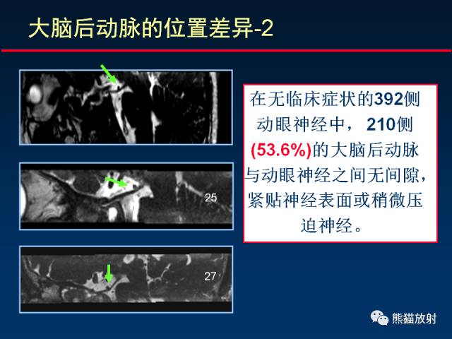 【柳澄讲坛】MR新技术在颅神经研究中的应用