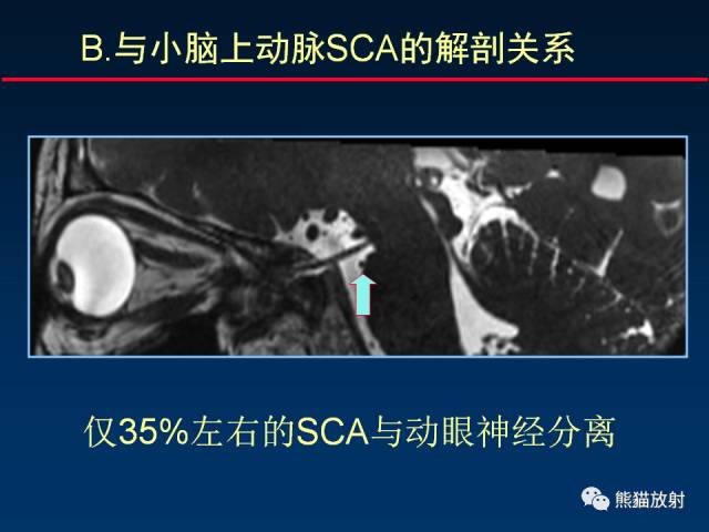 【柳澄讲坛】MR新技术在颅神经研究中的应用