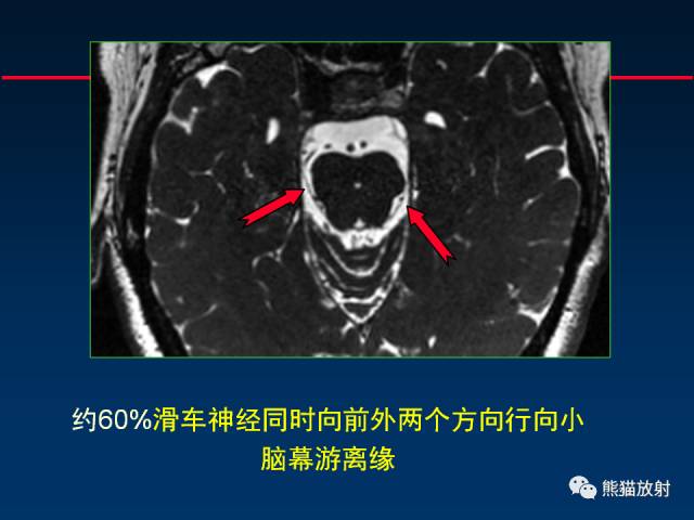 【柳澄讲坛】MR新技术在颅神经研究中的应用