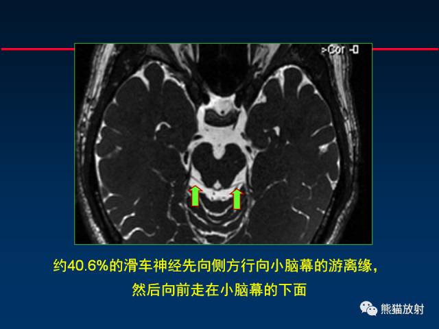 【柳澄讲坛】MR新技术在颅神经研究中的应用