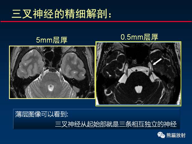【柳澄讲坛】MR新技术在颅神经研究中的应用