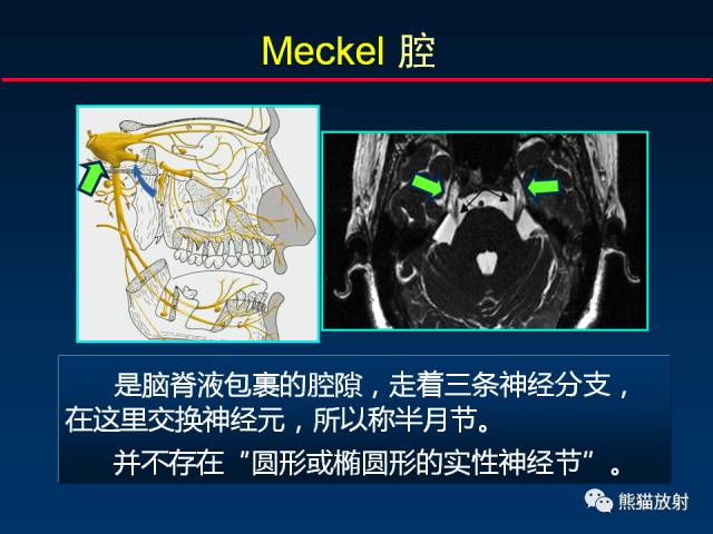 【柳澄讲坛】MR新技术在颅神经研究中的应用