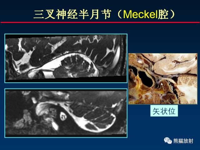 【柳澄讲坛】MR新技术在颅神经研究中的应用