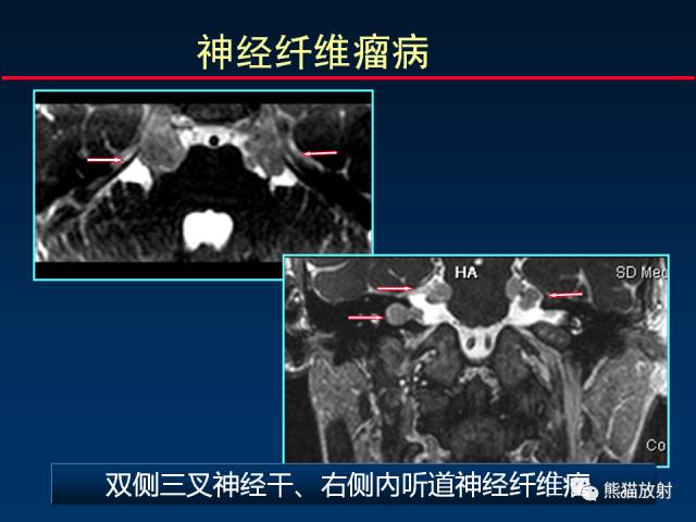 【柳澄讲坛】MR新技术在颅神经研究中的应用
