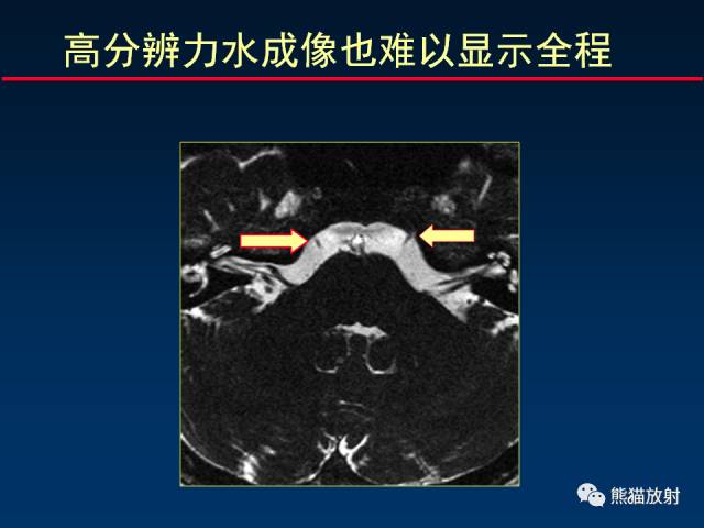 【柳澄讲坛】MR新技术在颅神经研究中的应用