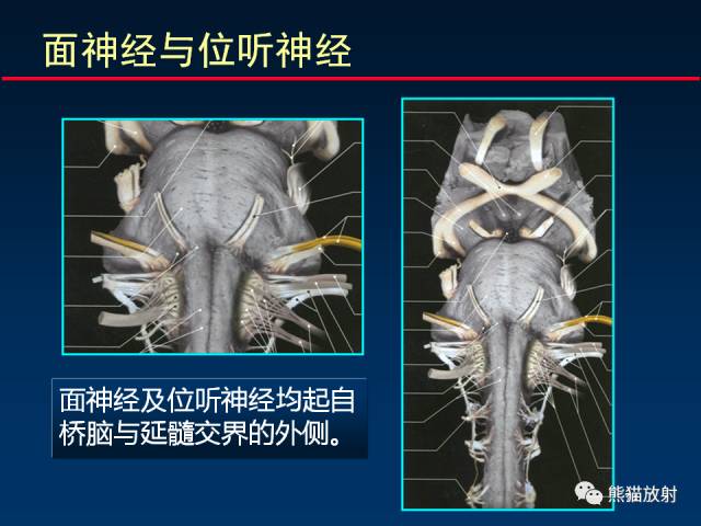 【柳澄讲坛】MR新技术在颅神经研究中的应用