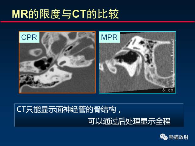 【柳澄讲坛】MR新技术在颅神经研究中的应用