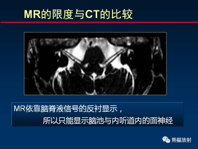 【柳澄讲坛】MR新技术在颅神经研究中的应用