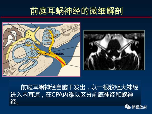 【柳澄讲坛】MR新技术在颅神经研究中的应用