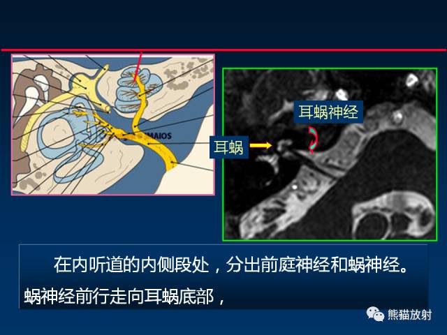 【柳澄讲坛】MR新技术在颅神经研究中的应用