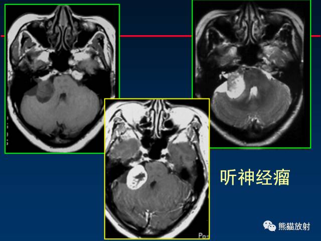 【柳澄讲坛】MR新技术在颅神经研究中的应用