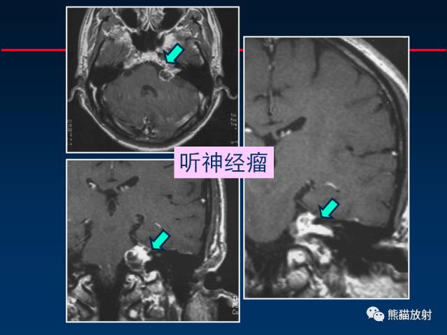 【柳澄讲坛】MR新技术在颅神经研究中的应用