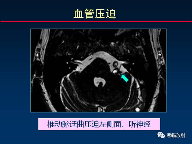 【柳澄讲坛】MR新技术在颅神经研究中的应用