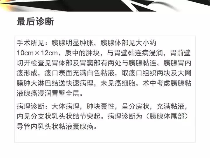 【病例】胰腺导管内乳头状粘液囊腺癌1例CT