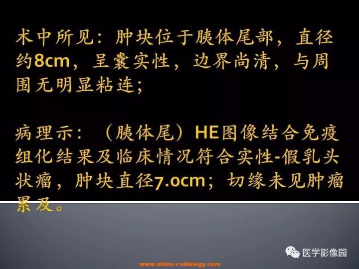 【病例】胰腺实性假乳头状瘤1例CT影像表现