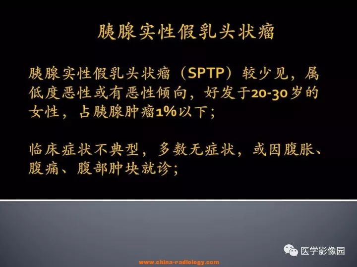 【病例】胰腺实性假乳头状瘤1例CT影像表现