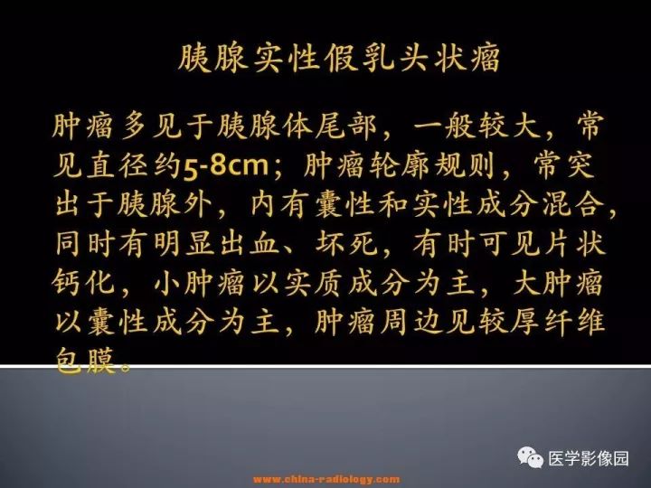 【病例】胰腺实性假乳头状瘤1例CT影像表现