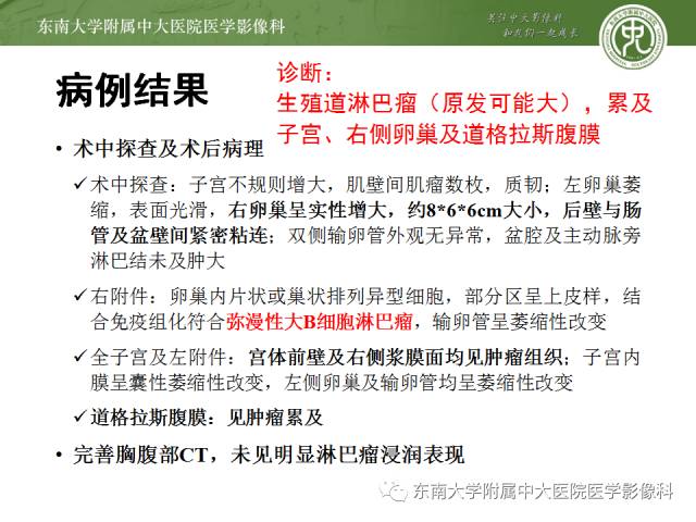 【病例】生殖系统淋巴瘤1例MR影像表现