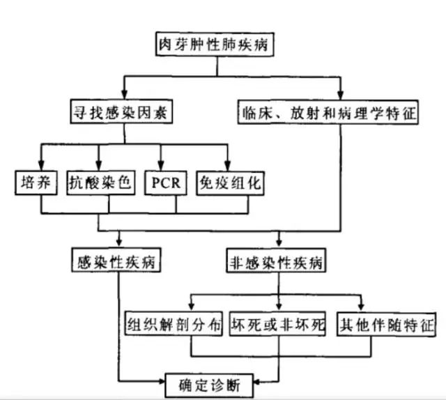 【病例】肺异物性肉芽肿1例CT影像表现 【病例】肺异物性肉芽肿1例CT影像表现