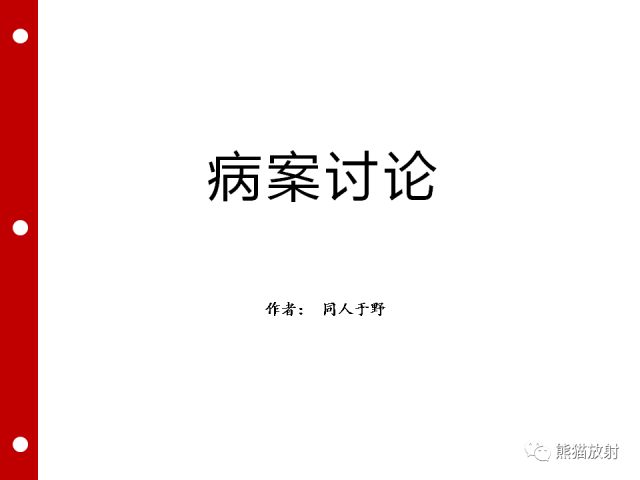 【病例】误诊为壁间血肿的腹膜后纤维化1例CT/PET影像表现