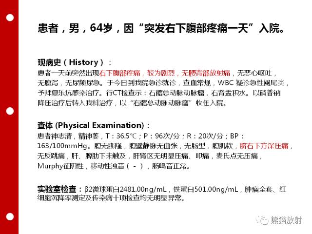 【病例】误诊为壁间血肿的腹膜后纤维化1例CT/PET影像表现