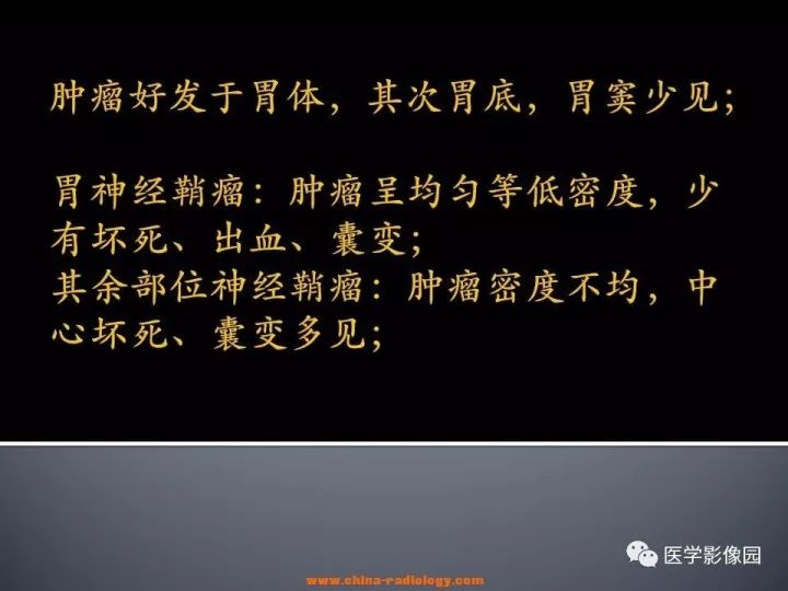 【病例】胃神经鞘瘤1例CT影像表现