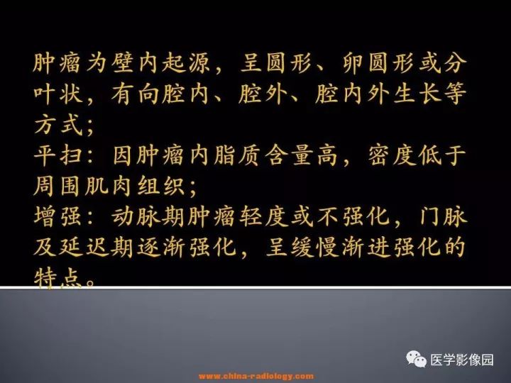 【病例】胃神经鞘瘤1例CT影像表现