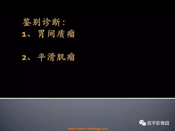 【病例】胃神经鞘瘤1例CT影像表现