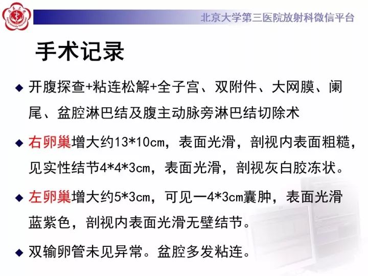 【病例】子宫内膜异位相关性卵巢癌1例MR