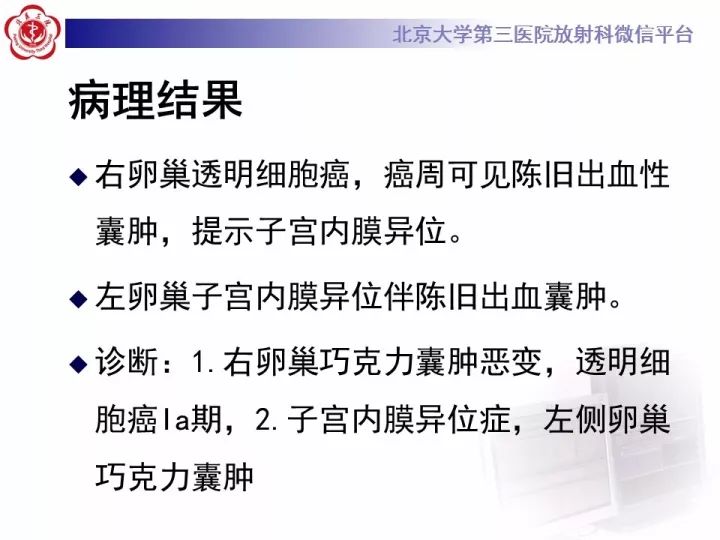 【病例】子宫内膜异位相关性卵巢癌1例MR