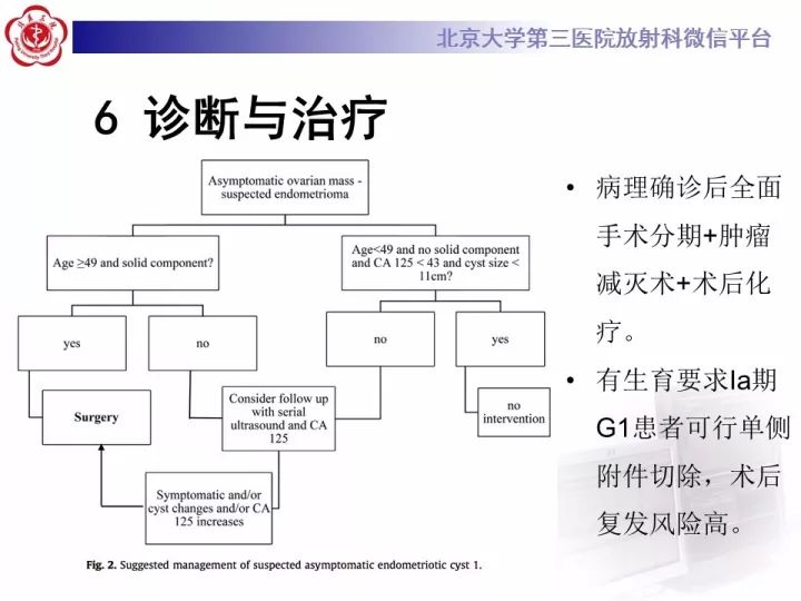 【病例】子宫内膜异位相关性卵巢癌1例MR