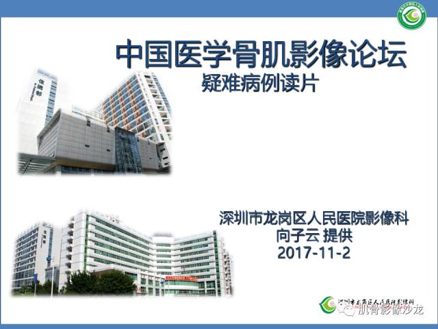 【病例】罗道病RDD一例CT及MR影像表现 【病例】罗道病RDD一例CT及MR影像表现