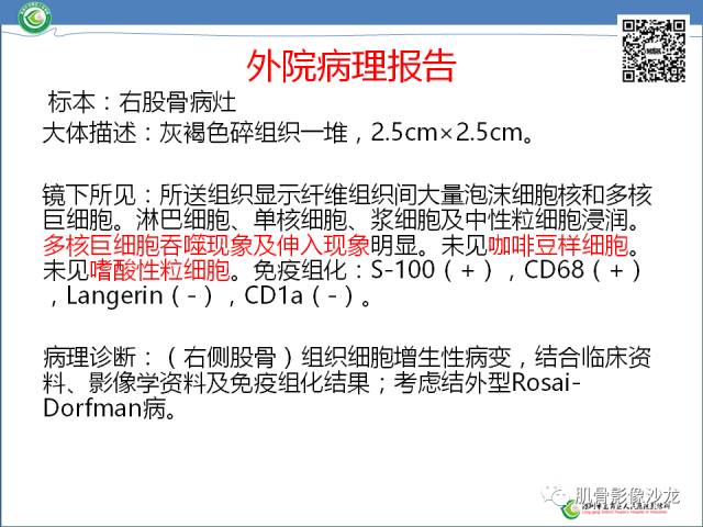 【病例】罗道病RDD一例CT及MR影像表现 【病例】罗道病RDD一例CT及MR影像表现