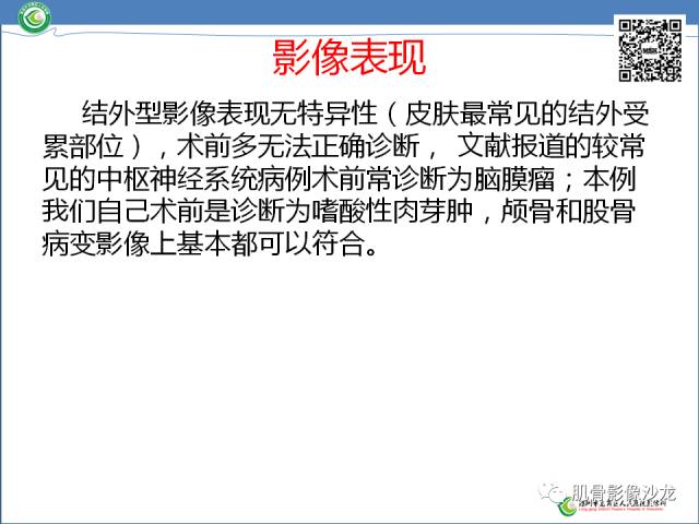 【病例】罗道病RDD一例CT及MR影像表现 【病例】罗道病RDD一例CT及MR影像表现