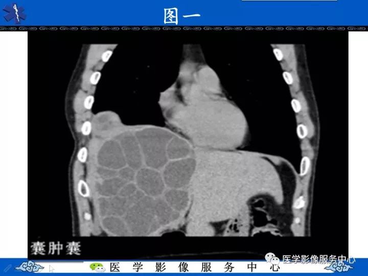 【影像征象】