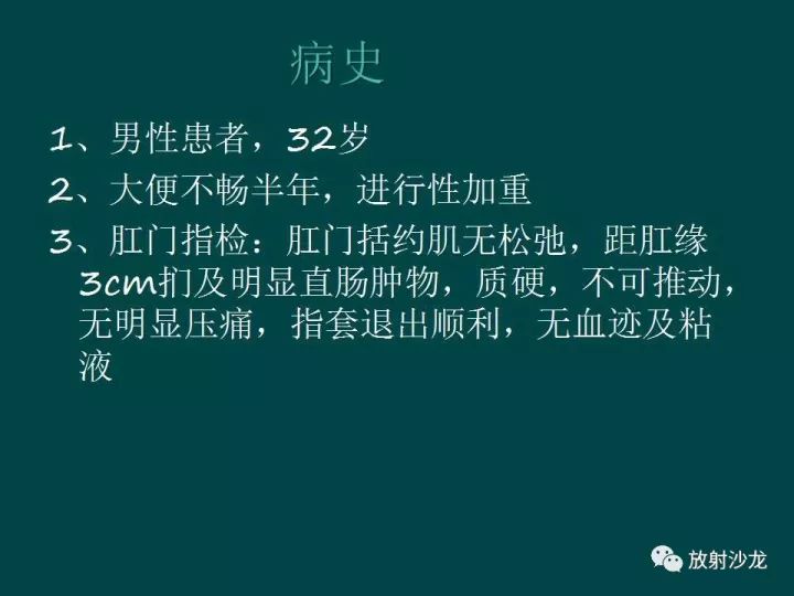 【病例】促结缔组织增生性小圆细胞肿瘤1例CT影像表现