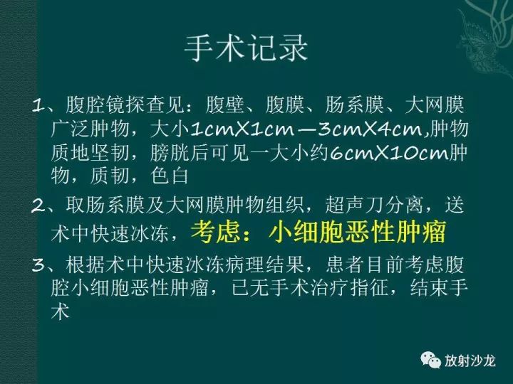 【病例】促结缔组织增生性小圆细胞肿瘤1例CT影像表现
