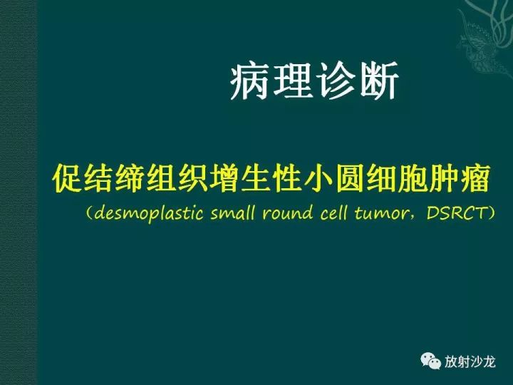 【病例】促结缔组织增生性小圆细胞肿瘤1例CT影像表现