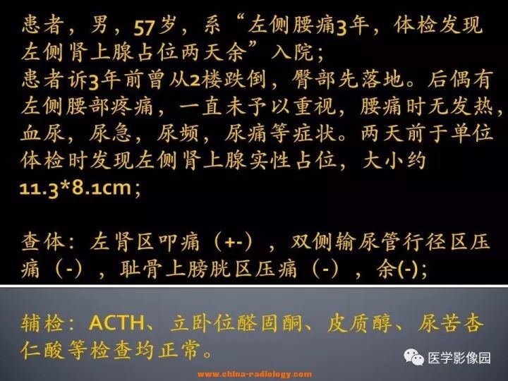 【病例】肾上腺嗜酸细胞腺瘤1例CT影像表现