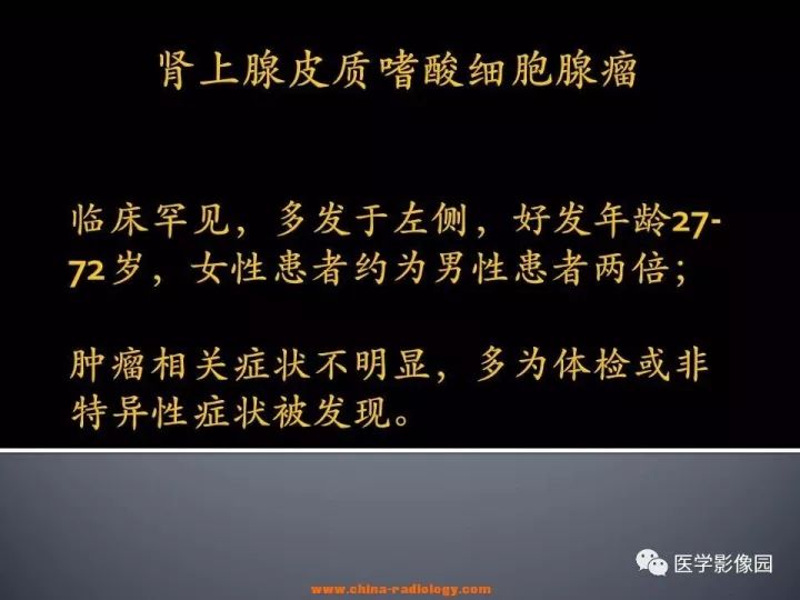 【病例】肾上腺嗜酸细胞腺瘤1例CT影像表现