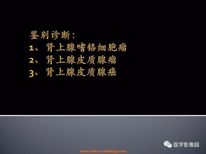 【病例】肾上腺嗜酸细胞腺瘤1例CT影像表现
