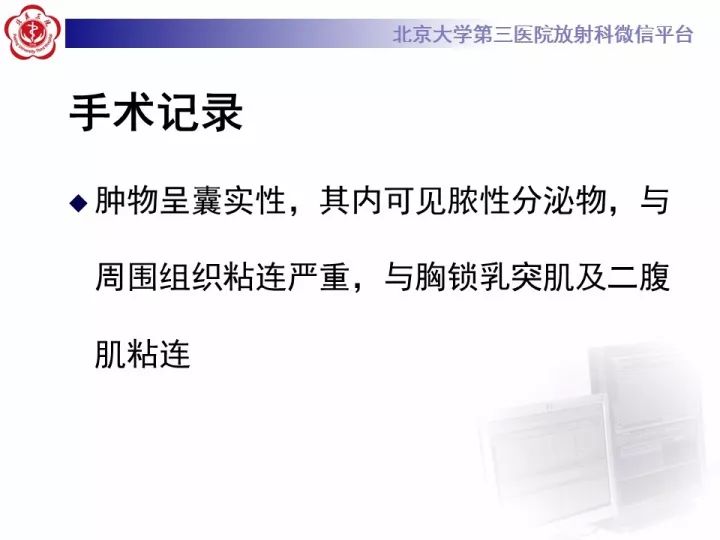 【病例】颈部囊性病例3例