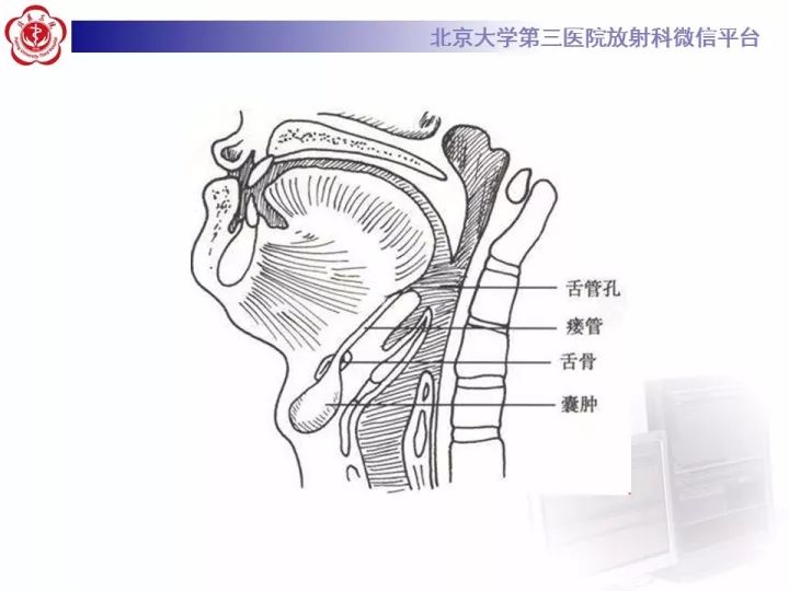 【病例】颈部囊性病例3例