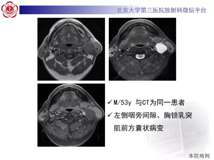 【病例】颈部囊性病例3例