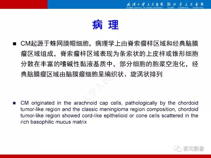 【病例】脊索样脑膜瘤1例MR影像诊断