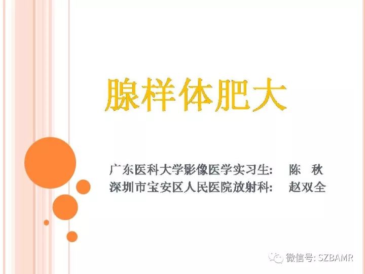 【PPT】腺样体肥大