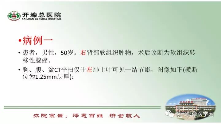 【病例】肺部结节病6例读片