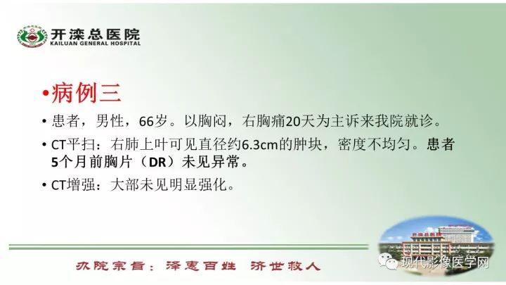 【病例】肺部结节病6例读片