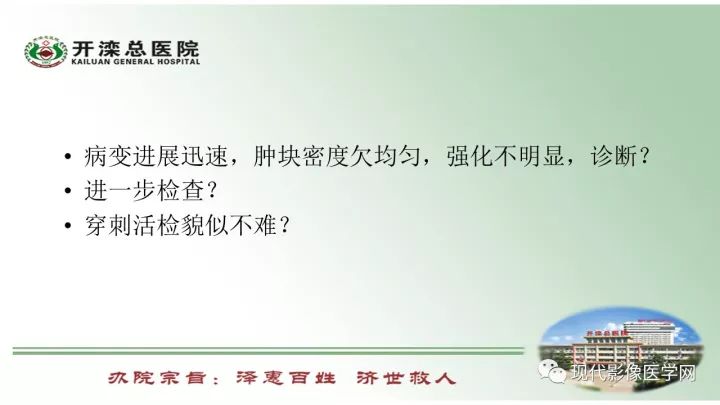 【病例】肺部结节病6例读片